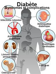 Diabète : symptômes, causes, diagnostic et traitements